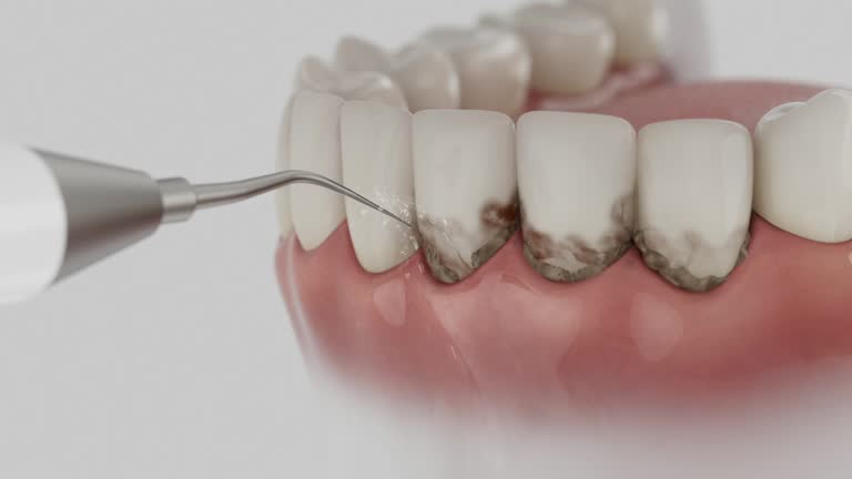 Reliable Wisdom Tooth Removal contractor in Santa Barbara County County, CA by Dentist Open Now
